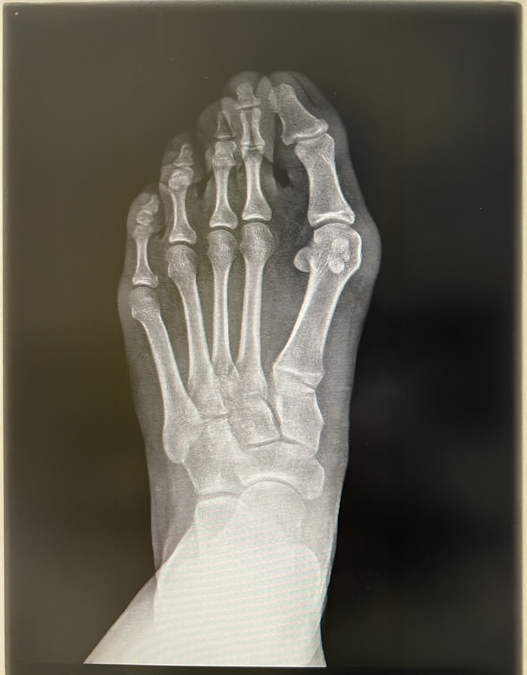 x-ray 2.jpg