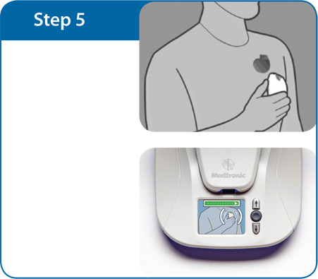 Oliver Segal Medtronic Mycare step 5.jpg