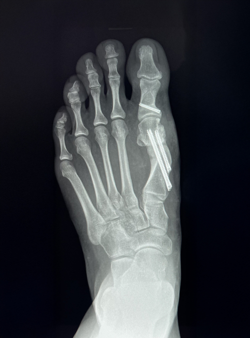 x-ray 1.jpg