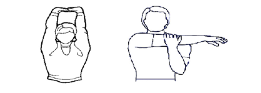 Oliver Segal After a Pacemaker arm movements.jpg