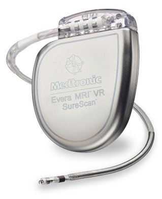 Oliver Segal treatment of ventricular Arrhythmia Medtronic-ICD.jpg