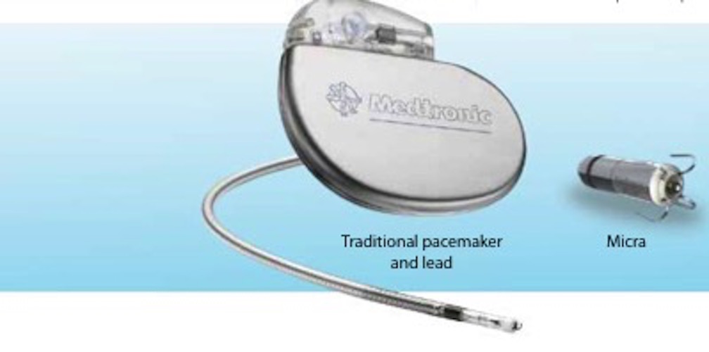 Oliver Segal medtronic micra.jpg
