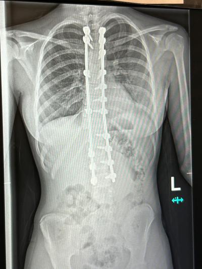 X-ray 2.jpg